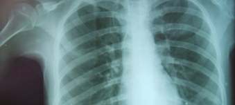 Investieren in Deutschland